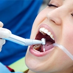 Porselen Kaplama Diş Temizliği