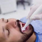 Diş Taşı Temizliği Fiyat
