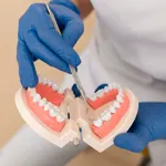 Protez Diş Fiyatları